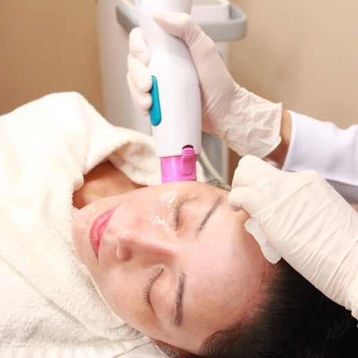 Thermage FLX เชียงใหม่