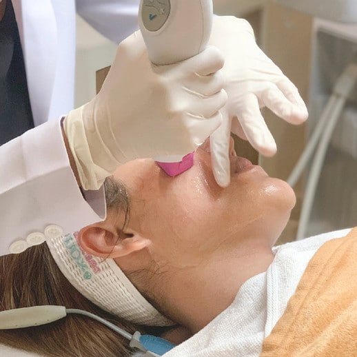 Thermage FLX เชียงใหม่