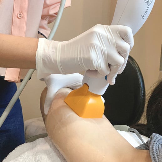 Thermage FLX เชียงใหม่