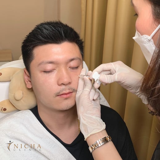 Filler เชียงใหม่