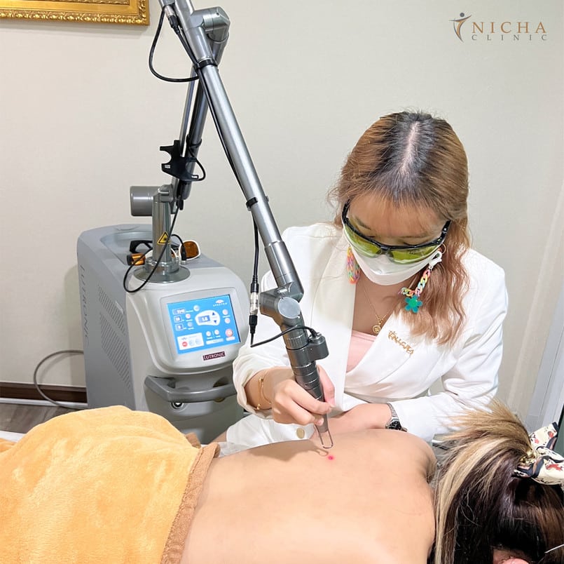 Spectra Gold เชียงใหม่