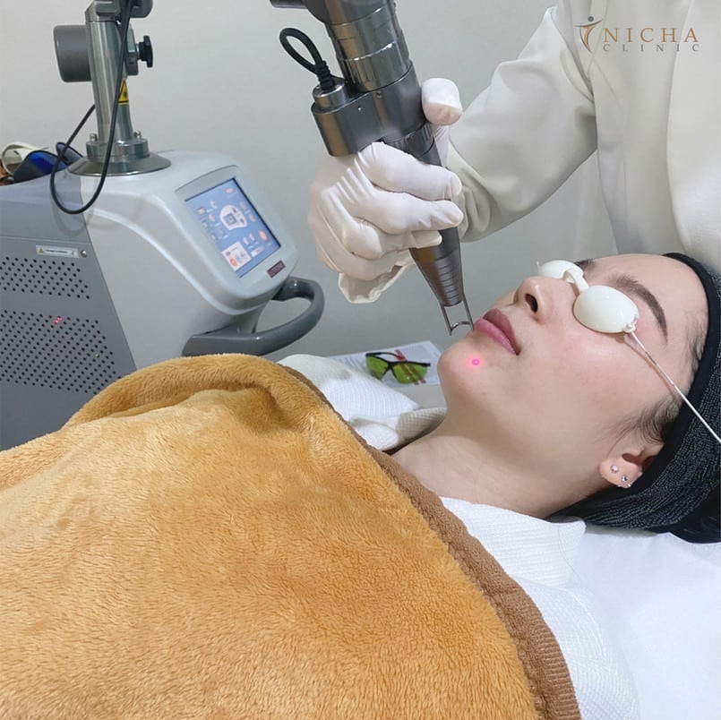 Spectra Gold เชียงใหม่