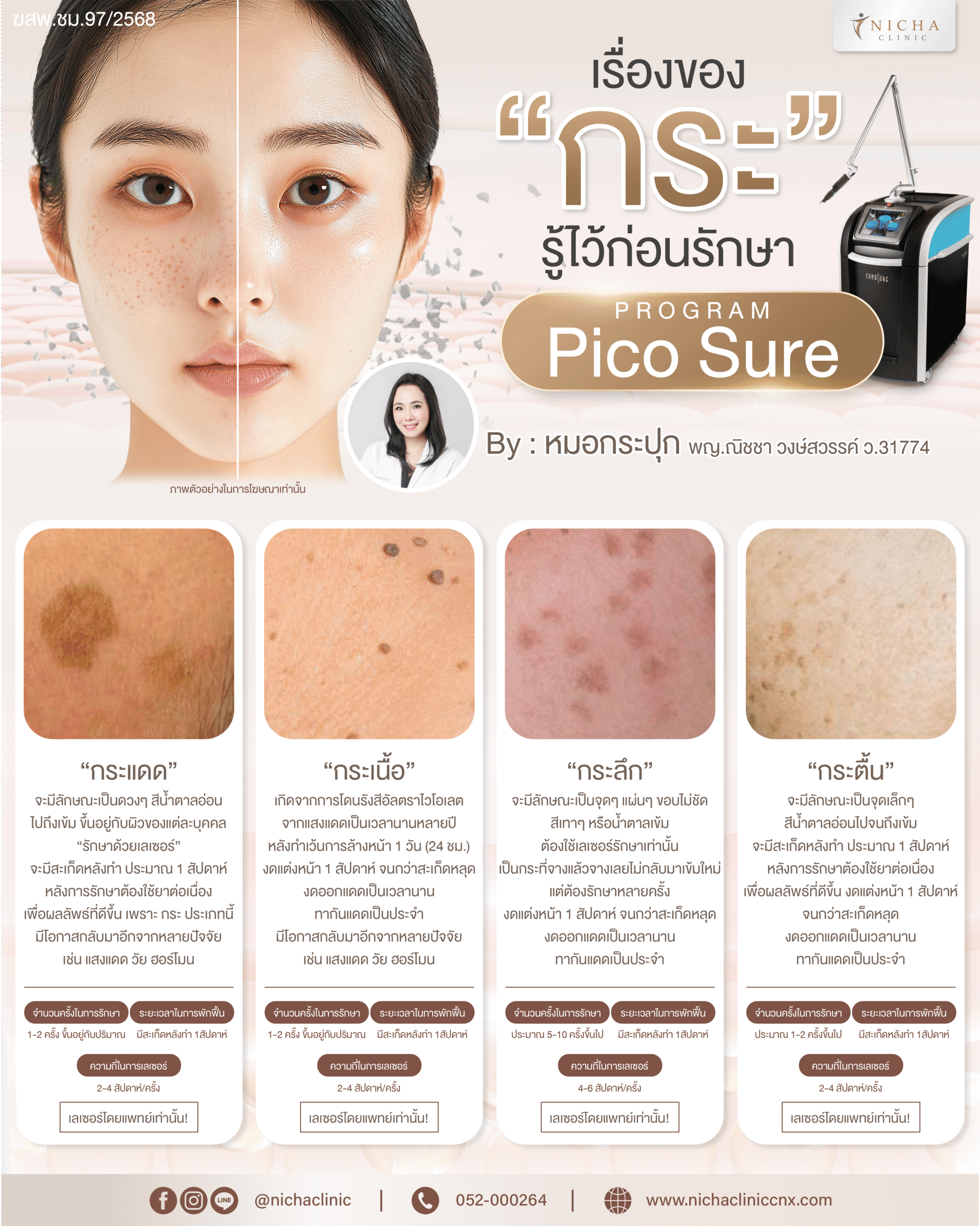 content-ฝ้ากระ